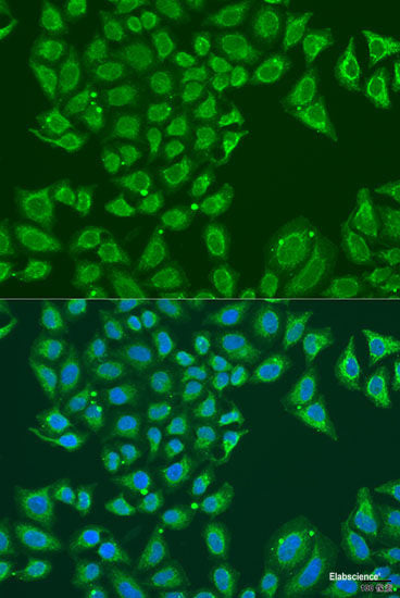 Immunofluorescence analysis of U-2 OS cells using UPF1 Polyclonal Antibody at dilution of  1:100. Blue: DAPI for nuclear staining.