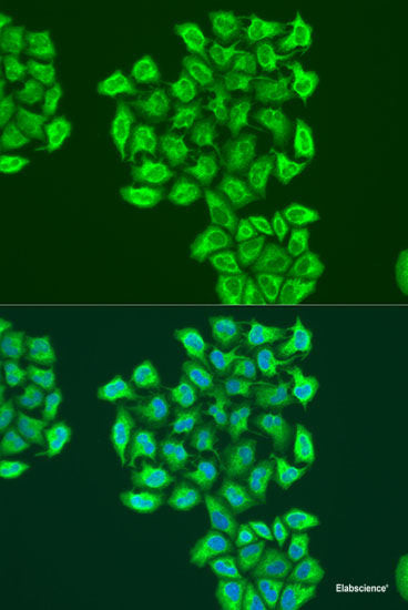 Immunofluorescence analysis of Hela cells using SLC24A5 Polyclonal Antibody at dilution of  1:100 (40x lens). Blue: DAPI for nuclear staining.