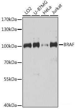 Immunofluorescence analysis of Hela cells using PLA2G4D Polyclonal Antibody at dilution of  1:100 (40x lens). Blue: DAPI for nuclear staining.