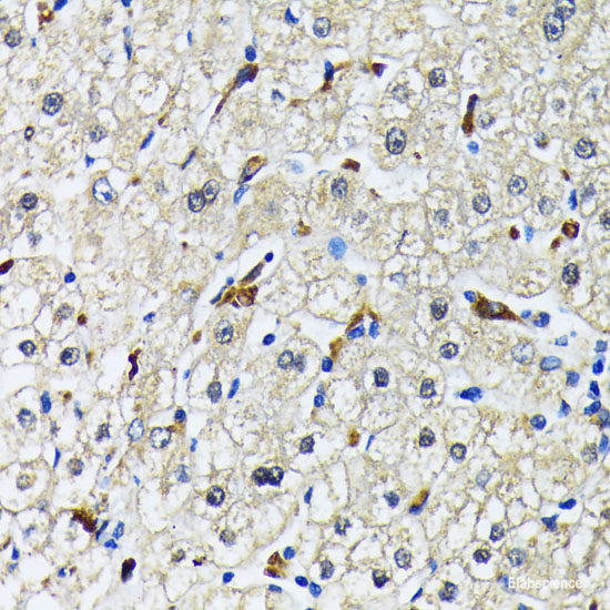 Immunohistochemistry of paraffin-embedded Rat lung using SUMO2 Polyclonal Antibody at dilution of  1:100 (40x lens).
