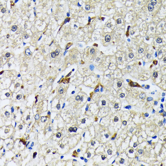 Immunohistochemistry of paraffin-embedded Rat lung using SUMO2 Polyclonal Antibody at dilution of  1:100 (40x lens).