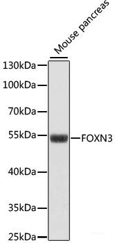 Immunohistochemistry of paraffin-embedded Rat brain using SLC6A3 Polyclonal Antibody at dilution of  1:200 (40x lens).