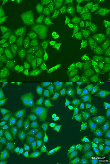 Immunofluorescence analysis of C6 cells using ARL1 Polyclonal Antibody at dilution of  1:100 (40x lens). Blue: DAPI for nuclear staining.