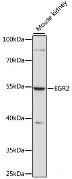Immunohistochemistry of paraffin-embedded Rat heart using FLII Polyclonal Antibody at dilution of  1:100 (40x lens).