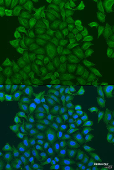 Immunohistochemistry of paraffin-embedded Rat heart using KCNJ15 Polyclonal Antibody at dilution of  1:100 (40x lens).