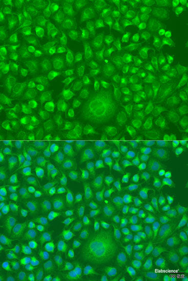 Immunohistochemistry of paraffin-embedded Human colon using KIF22 Polyclonal Antibody at dilution of  1:100 (40x lens).