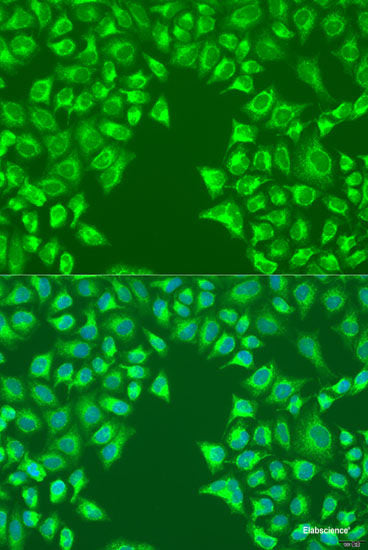 Immunohistochemistry of paraffin-embedded Rat liver using PFDN4 Polyclonal Antibody at dilution of  1:100 (40x lens).