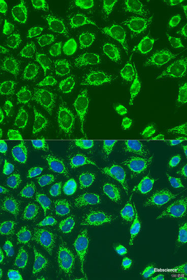 Immunohistochemistry of paraffin-embedded Rat kidney using PLS1 Polyclonal Antibody at dilution of  1:100 (40x lens).