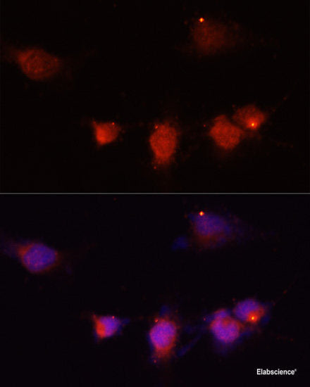 Immunofluorescence analysis of U-2 OS cells using ROBO1 Polyclonal Antibody at dilution of  1:100 (40x lens). Blue: DAPI for nuclear staining.