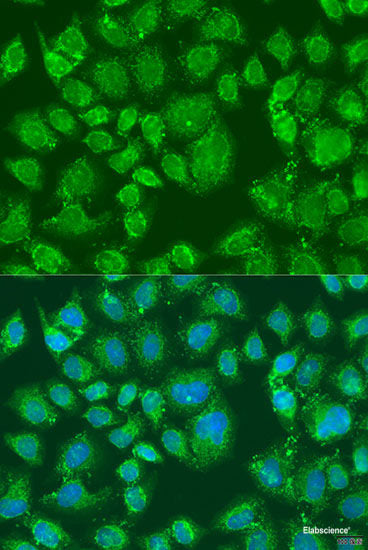 Immunohistochemistry of paraffin-embedded Human tonsil using S100A8 Polyclonal Antibody at dilution of  1:200 (40x lens).