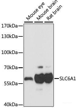 Immunohistochemistry of paraffin-embedded Rat heart using TRIP4 Polyclonal Antibody at dilution of  1:100 (40x lens).