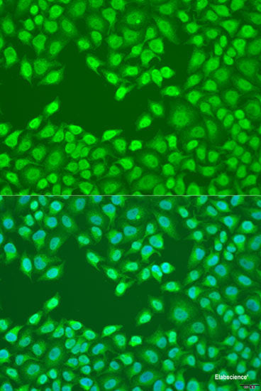 Immunofluorescence analysis of HeLa cells using VAV3 Polyclonal Antibody at dilution of  1:100. Blue: DAPI for nuclear staining.