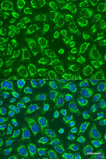 Immunofluorescence analysis of A431 cells using ACOT9 Polyclonal Antibody at dilution of  1:100. Blue: DAPI for nuclear staining.