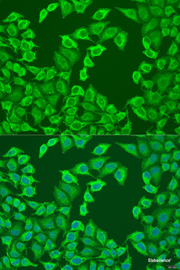 Immunohistochemistry of paraffin-embedded Rat ovary using KANK2 Polyclonal Antibody at dilution of  1:100 (40x lens).
