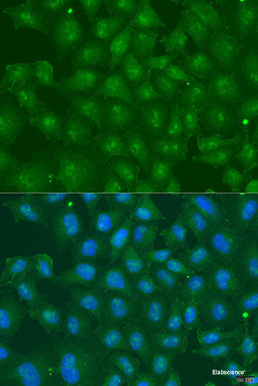 Immunohistochemistry of paraffin-embedded Rat brain using AK5 Polyclonal Antibody at dilution of  1:100 (40x lens).