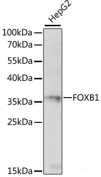 Immunofluorescence analysis of U-2 OS cells using SULT1C4 Polyclonal Antibody at dilution of  1:100. Blue: DAPI for nuclear staining.