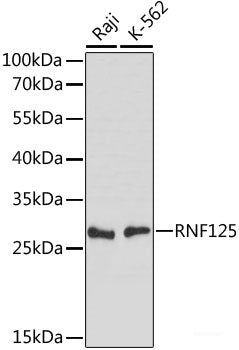 Immunofluorescence analysis of C6 cells using DDX24 Polyclonal Antibody at dilution of  1:100. Blue: DAPI for nuclear staining.