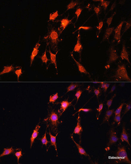 Immunofluorescence analysis of U-2 OS cells using RBM25 Polyclonal Antibody at dilution of  1:100. Blue: DAPI for nuclear staining.