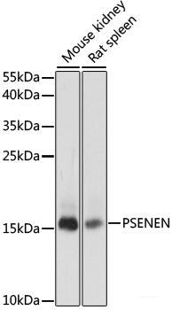 Immunofluorescence analysis of HeLa cells using MRPS14 Polyclonal Antibody at dilution of  1:100. Blue: DAPI for nuclear staining.