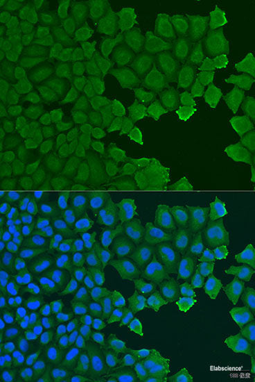 Immunofluorescence analysis of C6 cells using HOPX Polyclonal Antibody at dilution of  1:100. Blue: DAPI for nuclear staining.