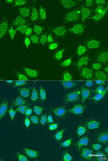 Immunofluorescence analysis of Rat testis using TPD52L3 Polyclonal Antibody at dilution of  1:100. Blue: DAPI for nuclear staining.