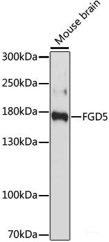 Immunohistochemistry of paraffin-embedded Human mammary cancer using LC3A / LC3B Polyclonal Antibody at dilution of  1:100 (40x lens).
