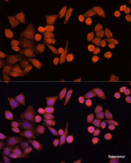 Immunohistochemistry of paraffin-embedded Rat testis using Twist Polyclonal Antibody at dilution of  1:100 (40x lens).