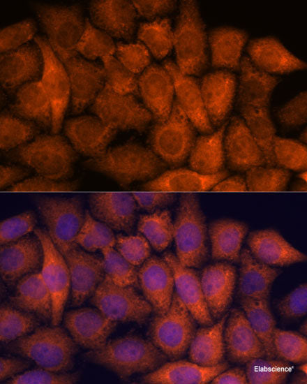 Immunohistochemistry of paraffin-embedded Rat kidney using ITCH Polyclonal Antibody at dilution of  1:50 (40x lens).