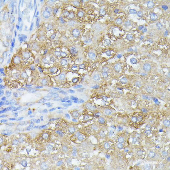 Immunofluorescence analysis of U2OS cells using ALB Polyclonal Antibody at dilution of  1:100. Blue: DAPI for nuclear staining.