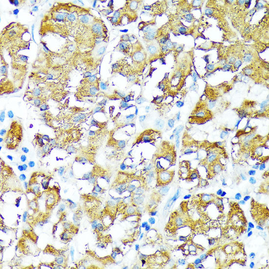 Immunohistochemistry of paraffin-embedded Rat brain using PPP2R5D Polyclonal Antibody at dilution of  1:100 (40x lens).