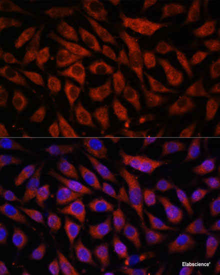 Immunohistochemistry of paraffin-embedded Rat liver using HP Polyclonal Antibody at dilution of  1:100 (40x lens).