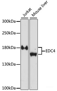 Immunofluorescence analysis of U2OS cells using SAFB Polyclonal Antibody at dilution of  1:100. Blue: DAPI for nuclear staining.