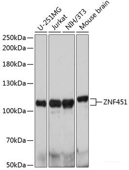 Immunofluorescence analysis of U2OS cells using AURKA Polyclonal Antibody at dilution of  1:100. Blue: DAPI for nuclear staining.
