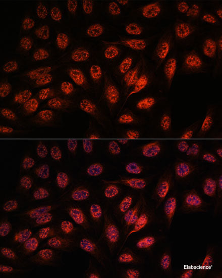 Immunofluorescence analysis of C6 cells using GOLGA5 Polyclonal Antibody at dilution of  1:100. Blue: DAPI for nuclear staining.