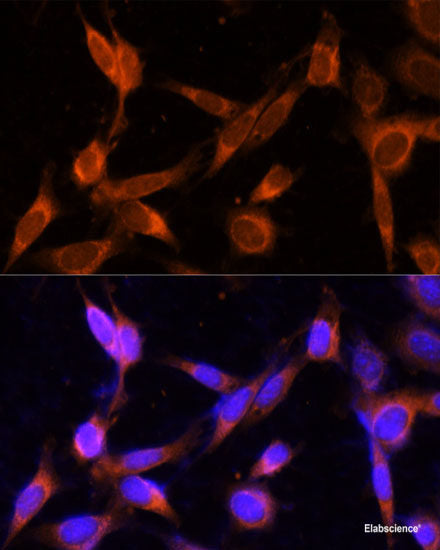 Immunofluorescence analysis of C6 cells using ACAA2 Polyclonal Antibody at dilution of  1:100. Blue: DAPI for nuclear staining.