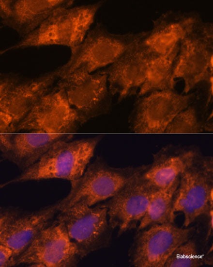 Immunofluorescence analysis of Rat bone marrow using CD11B Polyclonal Antibody at dilution of  1:100. Blue: DAPI for nuclear staining.