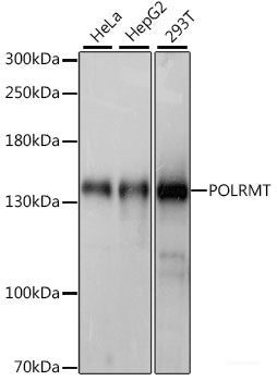 Immunohistochemistry of paraffin-embedded Rat brain using TIMM8B Polyclonal Antibody at dilution of  1:100 (40x lens).