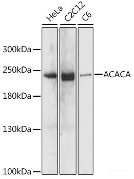 Immunohistochemistry of paraffin-embedded Rat brain using COPG2 Polyclonal Antibody at dilution of  1:100 (40x lens).