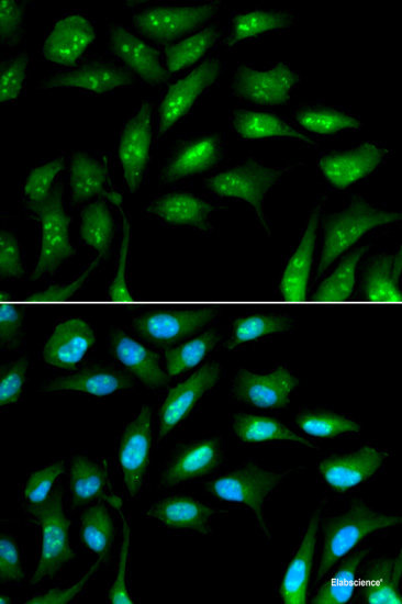 Immunofluorescence analysis of NIH-3T3 cells using PIK3R4 Polyclonal Antibody at dilution of  1:100 (40x lens). Blue: DAPI for nuclear staining.