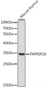 Immunofluorescence analysis of L929 cells using PLLP Polyclonal Antibody at dilution of  1:100. Blue: DAPI for nuclear staining.