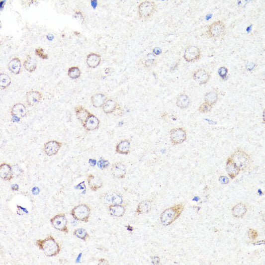 Immunofluorescence analysis of C6 cells using UBE2J1 Polyclonal Antibody at dilution of  1:100. Blue: DAPI for nuclear staining.