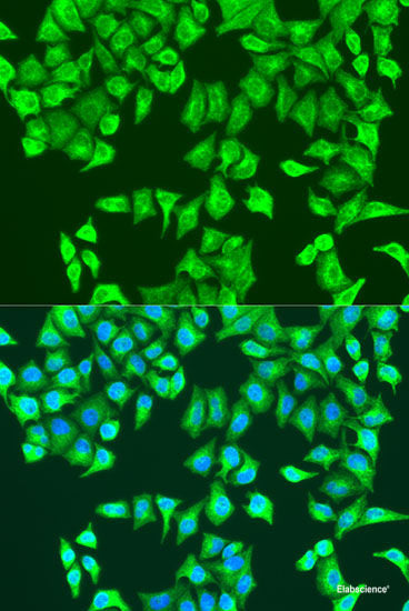 Immunofluorescence analysis of C6 cells using CCDC47 Polyclonal Antibody at dilution of  1:100. Blue: DAPI for nuclear staining.