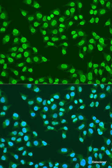 Immunofluorescence analysis of U-2 OS cells using WDR18 Polyclonal Antibody at dilution of  1:100. Blue: DAPI for nuclear staining.