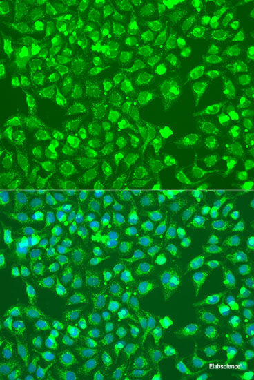 Immunohistochemistry of paraffin-embedded Rat brain using CHRNA7 Polyclonal Antibody at dilution of  1:100 (40x lens).