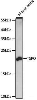 Immunofluorescence analysis of HeLa cells using KIF13A Polyclonal Antibody at dilution of  1:100. Blue: DAPI for nuclear staining.