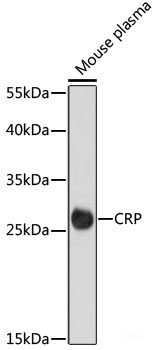 Immunofluorescence analysis of C6 cells using CEP85 Polyclonal Antibody at dilution of  1:100. Blue: DAPI for nuclear staining.
