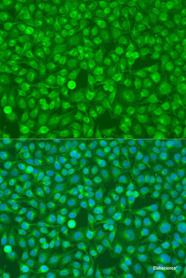 Immunofluorescence analysis of C6 cells using UPF3A Polyclonal Antibody at dilution of  1:100. Blue: DAPI for nuclear staining.