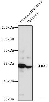 Immunofluorescence analysis of C6 cells using B3GNT4 Polyclonal Antibody at dilution of  1:100. Blue: DAPI for nuclear staining.