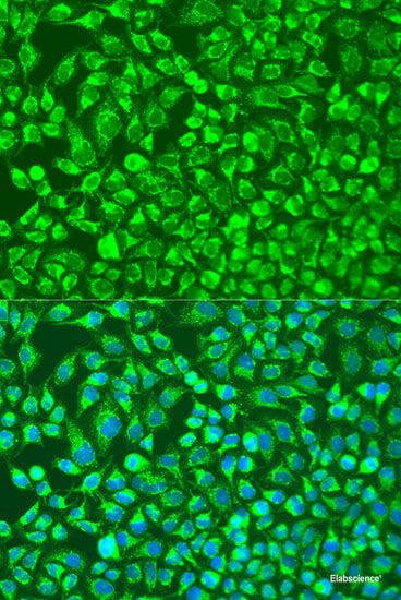 Immunofluorescence analysis of Rat testis using FER1L5 Polyclonal Antibody at dilution of  1:100. Blue: DAPI for nuclear staining.