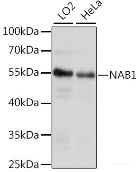 Immunohistochemistry of paraffin-embedded Rat kidney using BAD Polyclonal Antibody at dilution of  1:200 (40x lens).